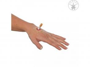 Cigaretta okozta seb